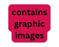 contains graphic images